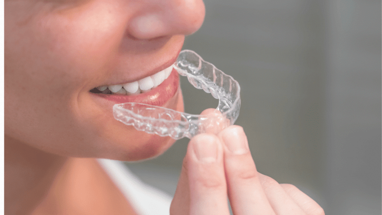 The Benefits of Cosmetic Dentistry: From Teeth Whitening to Smile Makeovers