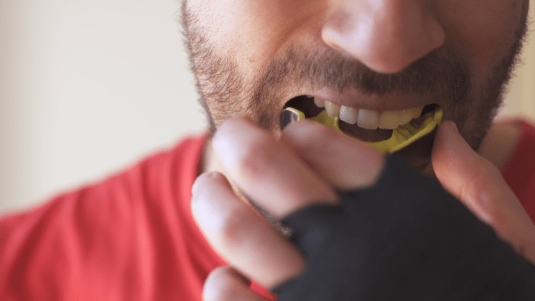 Sports Mouthguards for Kids & Adults: Why Every Athlete Should Wear One