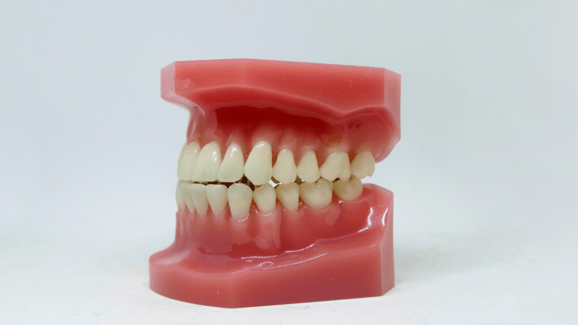 Why You Shouldn’t Ignore Gum Recession: Insights from the Dentists in Abu Dhabi