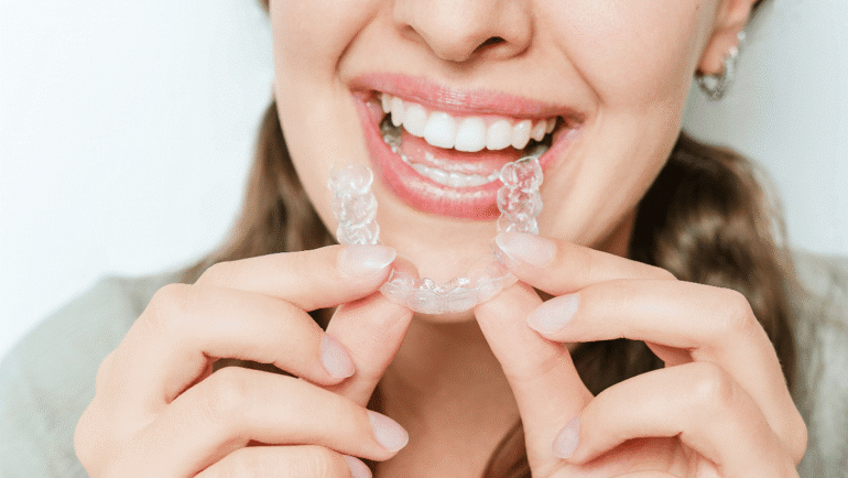 Why Are Retainers So Important?