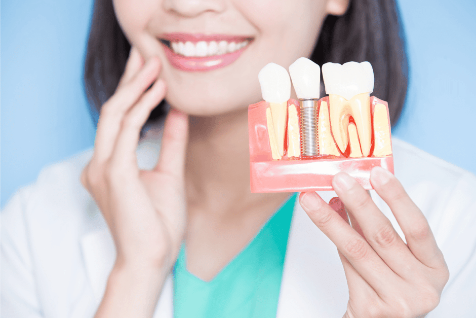 How to Care for Your Dental Implants: Tips for Long-Lasting Results