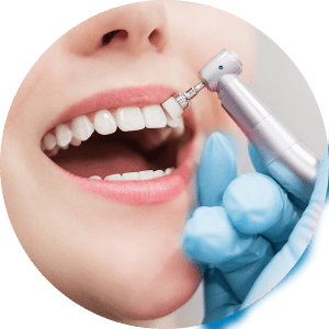 Oral Hygiene Services